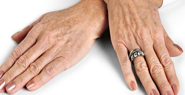 3 Hauptzeichen einer alternden Handhaut, die Ihr Alter verraten können