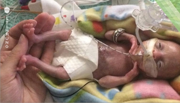 Keiner dachte, dass das Baby überleben würde, als es in der 21. Woche geboren wurde – so sieht sie heute aus!