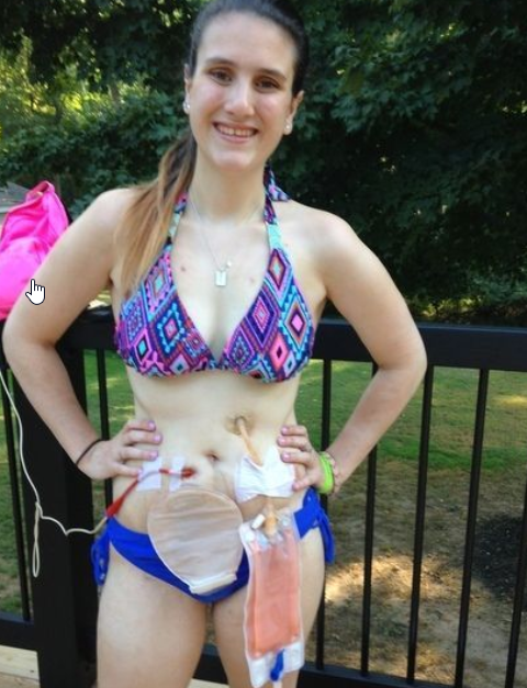 Diese 20 Jährige hat seit 2 Jahren nichts gegessen. Als sie einen Bikini trägt, verändert die Aussage einer Fremden alles!
