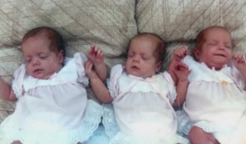 Diese 3 Babys wurden schwer verbrannt. Doch 27 Jahre später sehen sie SO aus.