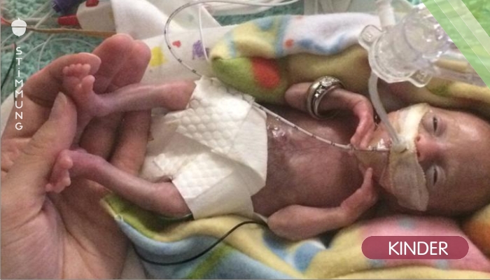 Dieses Baby wurde weltberühmt, als es in der 21. Woche geboren wurde und überlebte – so geht es ihr heute