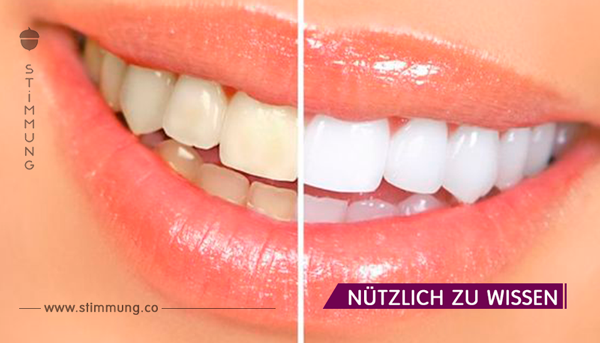 Zähne selbst aufhellen – ohne Chemie oder Zahnarzt.