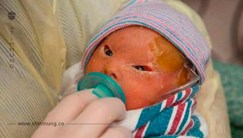 Das Aussehen ihrer Neugeborenen ist zunächst ein Schock – nun feiern Eltern auf der ganzen Welt die Worte dieser Mutter