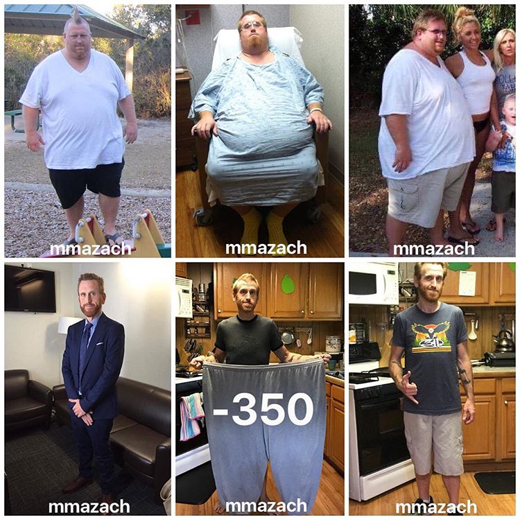 Der Mann wog 227 Kilo und verliert 159 kg für seinen „Helden“ – seinen autistischen Sohn
