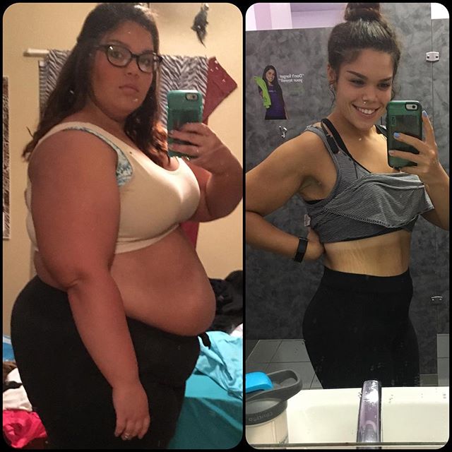 2 einfache Gewohnheiten haben diesem Mädchen geholfen, fast 80 kg zu verlieren!