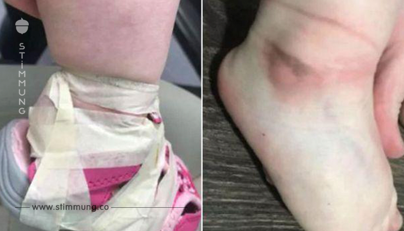 Schuhe des Kindes wurden mit Klebeband im Kindergarten befestigt – nun reagiert die Mutter auf Facebook	