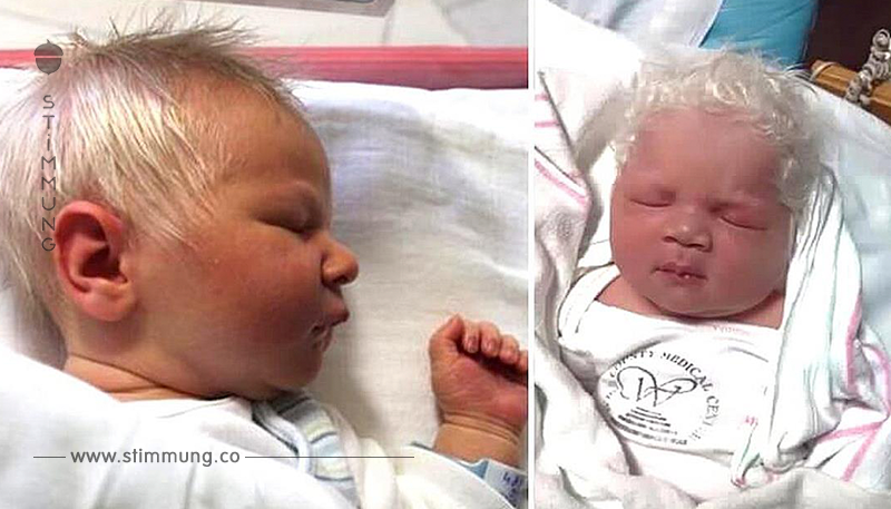 Junge mit schneeweißen Haaren geboren – doch die ärztliche Diagnose überrascht die Mutter	