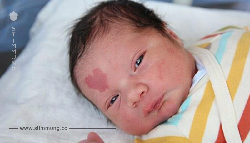 Foto von Baby mit seltenem Mal auf der Stirn geht um die Welt.	