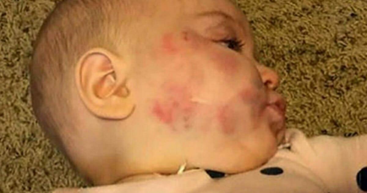 Baby im Kindergarten angegriffen: Überwachungskamera zeigt die furchtbare Wahrheit	