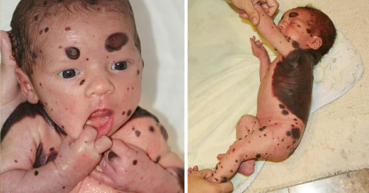 Baby wird mit blutigen Flecken geboren, Arzt offenbart, was keine Mutter hören möchte	