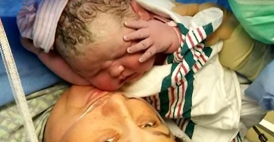 Krankenschwestern und Ärzte schrien laut beim Kaiserschnitt, bevor diese Mutter das niedlichste & größte Baby zur Welt brachte, das sie je gesehen hatten
