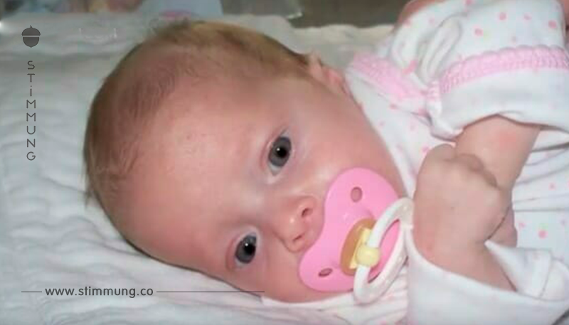 Ärzte sehen etwas im Bauch eines Babys wachsen: entdecken das gleiche Ding in Zwillingsschwester
