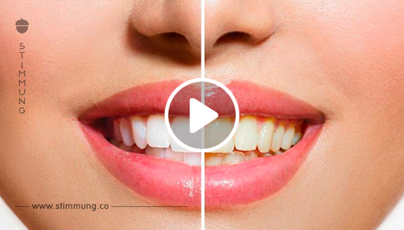 Zahnarztbesuch verhindern: Hier erfährst du, wie du das mit 2 Haushaltsmitteln schaffst