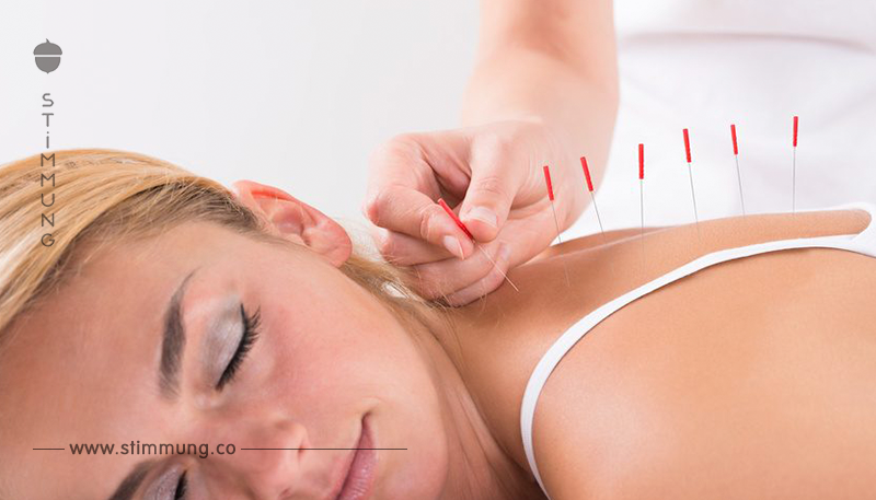Akupunktur: Sanftes Heilmittel oder Hokuspokus?