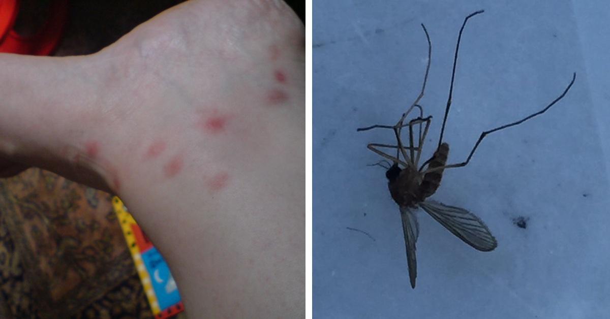 9 Dinge, die du diesen Sommer über Mücken wissen solltest.
