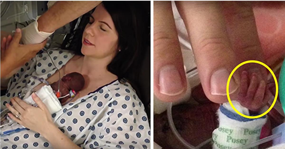 Mutter kann, zwei Wochen nach der Geburt, nun endlich ihr 340g schweres Baby im Arm halten