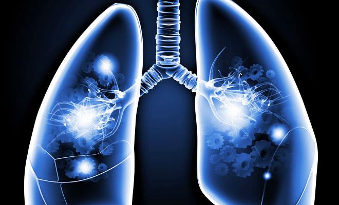 Spirometrie – der Lungencheck einfach erklärt
