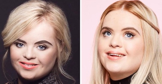 Ein junges Model mit Down Syndrom wird das neue Werbegesicht für eine Make up Marke