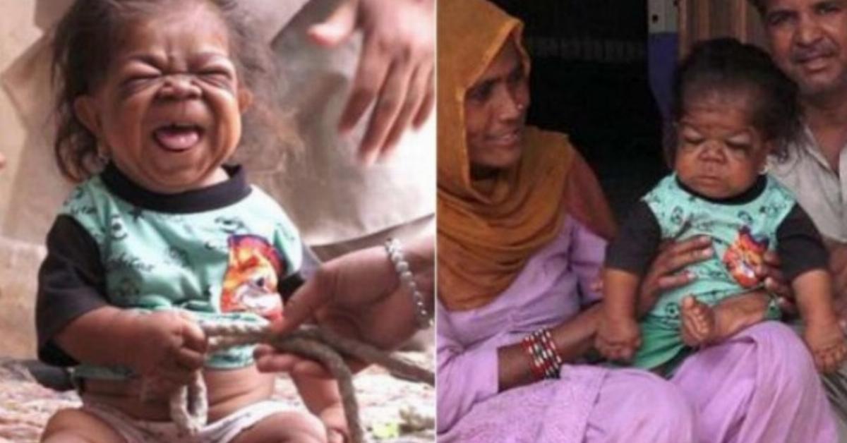 23-jähriger Inder ist gefangen im Körper eines Babys.