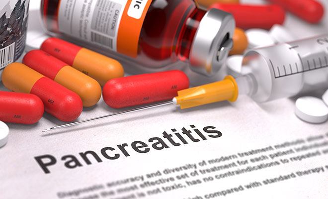 Pankreatitis: wenn sich die Bauchspeicheldrüse entzündet