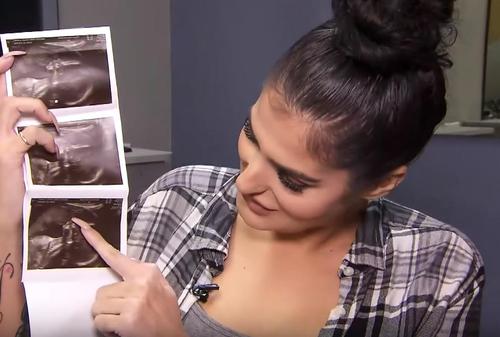San Diego Frau erkennt das Gesicht ihres verstorbenen Vaters im Ultraschallbild ihrer ungeborenen Tochter.