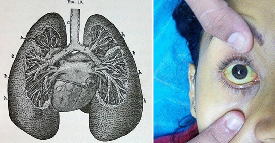 5 Warnsignale, die zeigen, dass deine Lunge nach Hilfe ruft