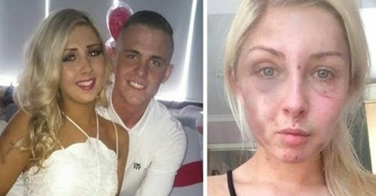 19 Jährige wird über mehrere Stunden von ihrem Freund blutig geschlagen – sie wollte ihm keine Zigarette geben