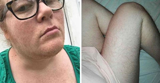 11 Frauen, die sich nicht mehr rasieren wollen