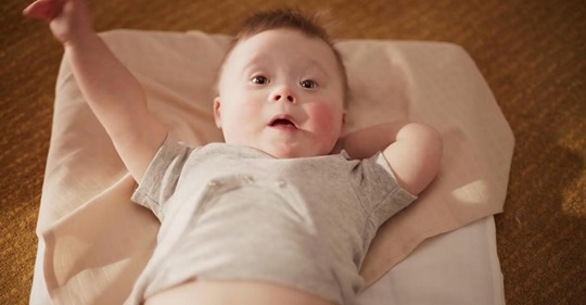 Babys mit Down Syndrom in Werbung für Baby Kosmetik