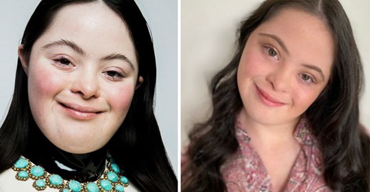 18 jähriges Model mit Down Syndrom wird neuer Star in Kampagne von Luxusmarke