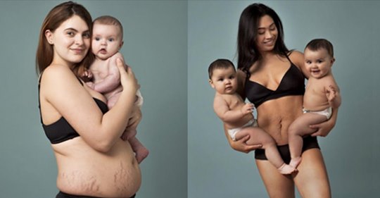12 Frauen zeigen ihre Körper nach der Schwangerschaft