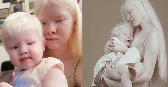 12 atemberaubende Fotos von Albino Schwestern