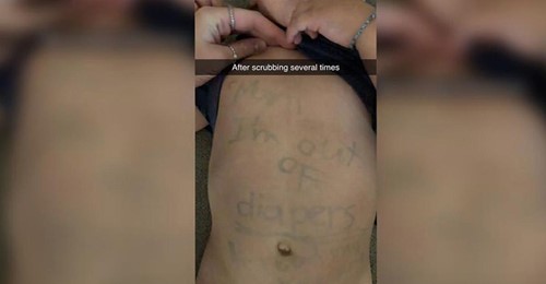 Mutter ignorierte Nachricht: Kita Mitarbeiterin kritzelt Notiz auf Bauch ihres Sohnes