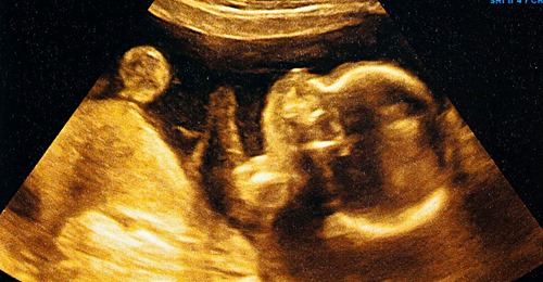 Wunder der Medizin: Paar bekommt Baby – durch 28 Jahre alten Eis Embryo