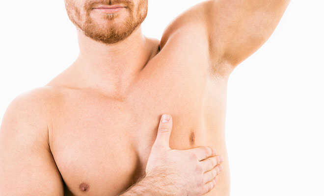 Gynäkomastie: Wenn ein Mann eine Brust entwickelt