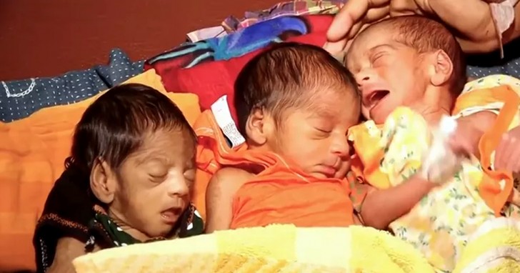 Eine Frau bringt ein Frühgeborenes zur Welt und bringt 27 Tage später Zwillinge zur Welt