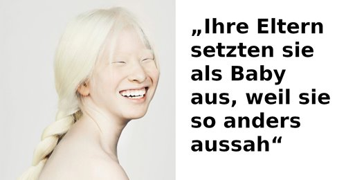Model Xueli Abbing wird wegen Albinismus als Baby ausgesetzt