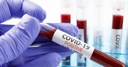 CoronavirusCorona Spätfolgen: Diese Langzeitschäden kann Covid 19 verursachen