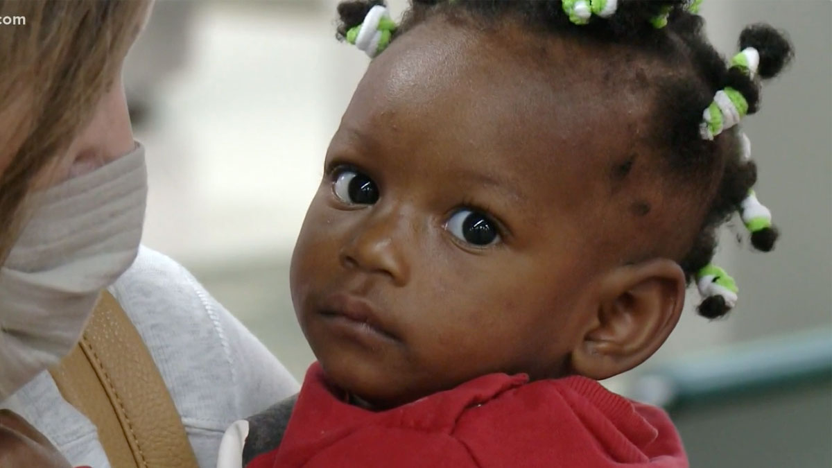 Familie aus den USA nimmt 10 Monate altes Mädchen aus Afrika auf, das sich einer kritischen Operation unterziehen muss