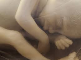 Mutter teilt Bilder von fehlgeborenem, 14 Wochen altem Fötus.