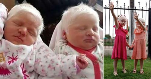 Frau bringt seltene Albino-Zwillinge mit schneeweißen Haaren zu Welt – so geht es ihnen heute