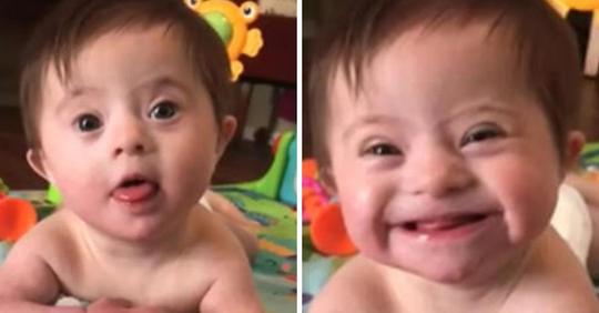 Baby mit Down-Syndrom wird berühmt, nachdem es seiner Adoptivmutter sein 'neues Lächeln' zeigte