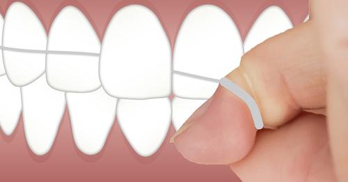 Zahnseide richtig benutzen: Diese Tipps haben sich bewährt