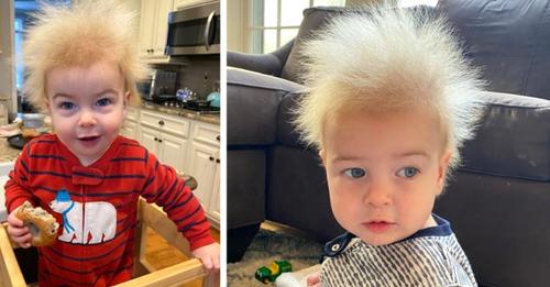 Dieser kleine Junge hat das Syndrom zerzauster Haare: 'Wir dachten, er bekäme lockiges Haar!'