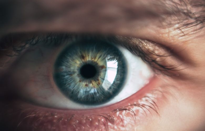 Augenmigräne: Das sind die Symptome und so kannst du es reduzieren.