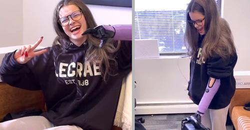 15 jähriges Mädchen lächelt wieder: Mit ihrer neuen Prothese fühlt sie sich wie eine Superheldin (+ VIDEO)