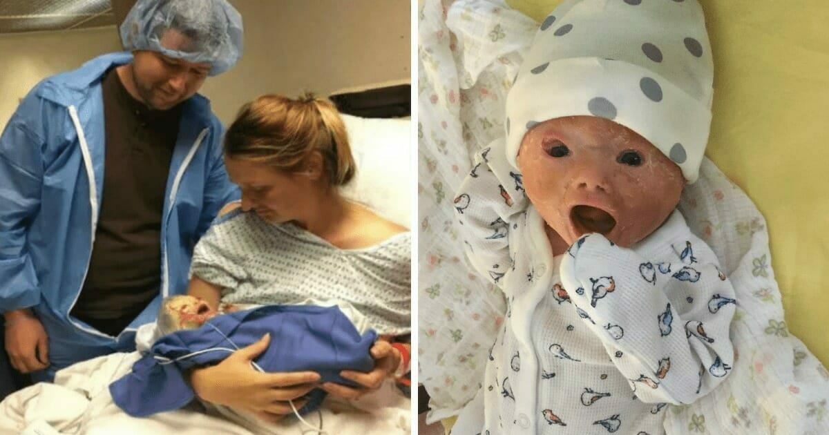 Ärzte müssen Not Kaiserschnitt durchführen – Vater sieht das Gesicht des Babys, und der Raum wird still